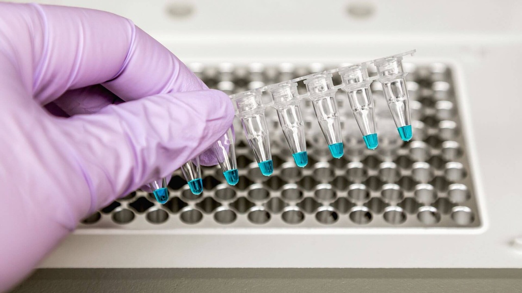 Img Importancia de los Equipos de PCR en la Investigación Biomédica