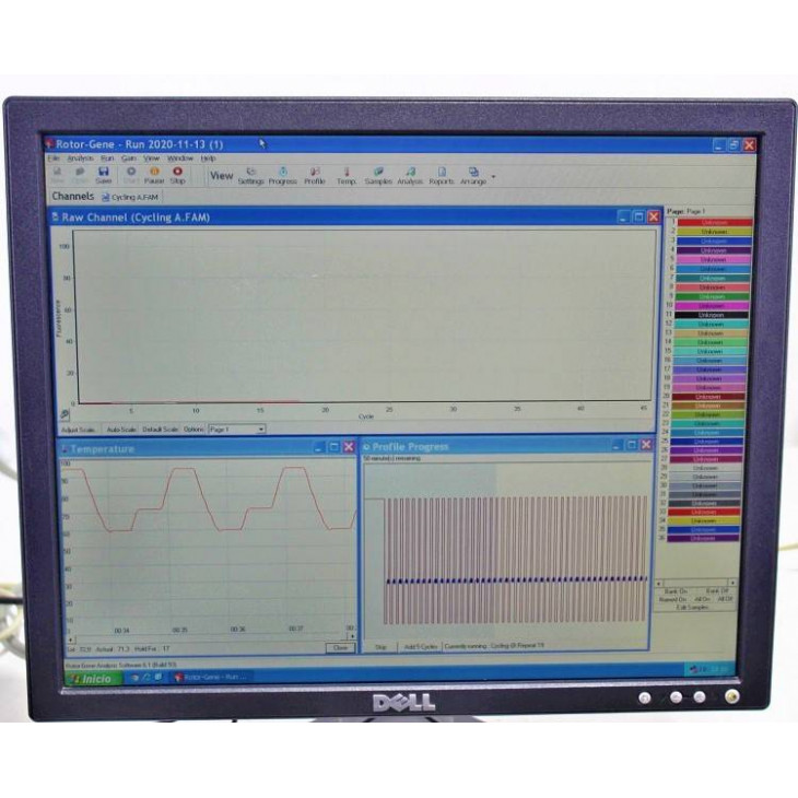 rt-pcr-corbett-rotor-gene-3000.jpg